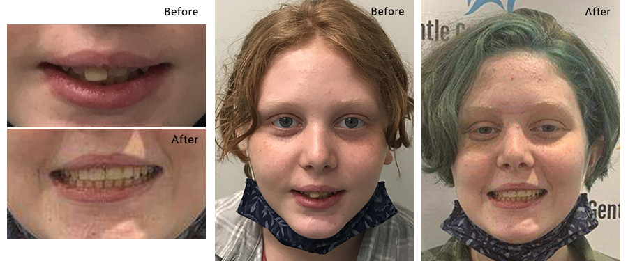 Before and After Treatment Image