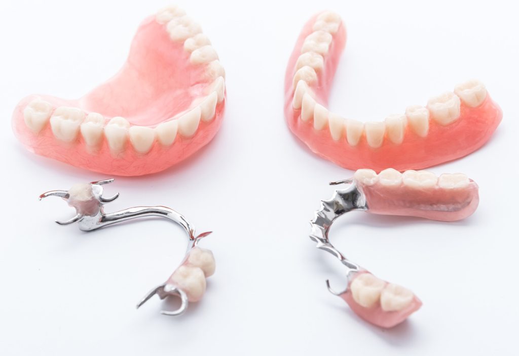 Removable Partials and Dentures Azusa CA